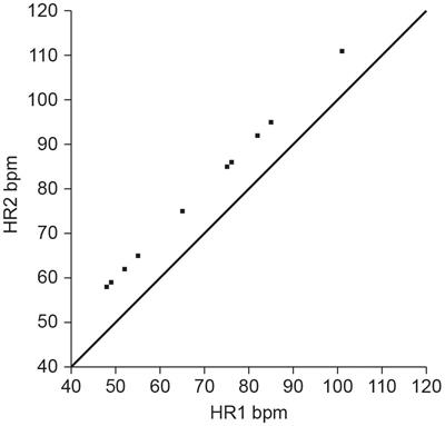 A Critical Review of Ultra-Short-Term Heart Rate Variability Norms Research